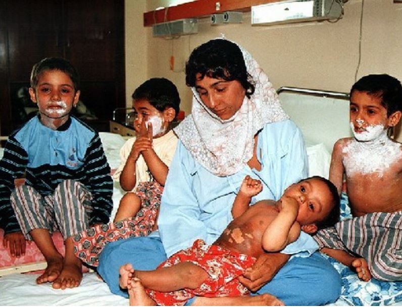 Hardal Ciğerlerde, İhanet Yüreklerde: Sardasht ve Kürt Katliamı Hikâyesi